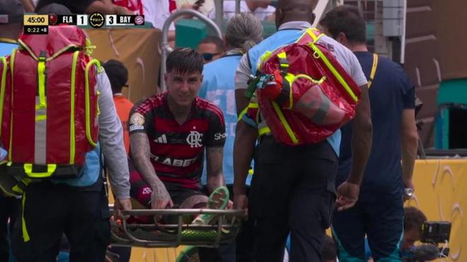 弗拉門戈中場拜仁傷退，骨折將缺陣兩月。